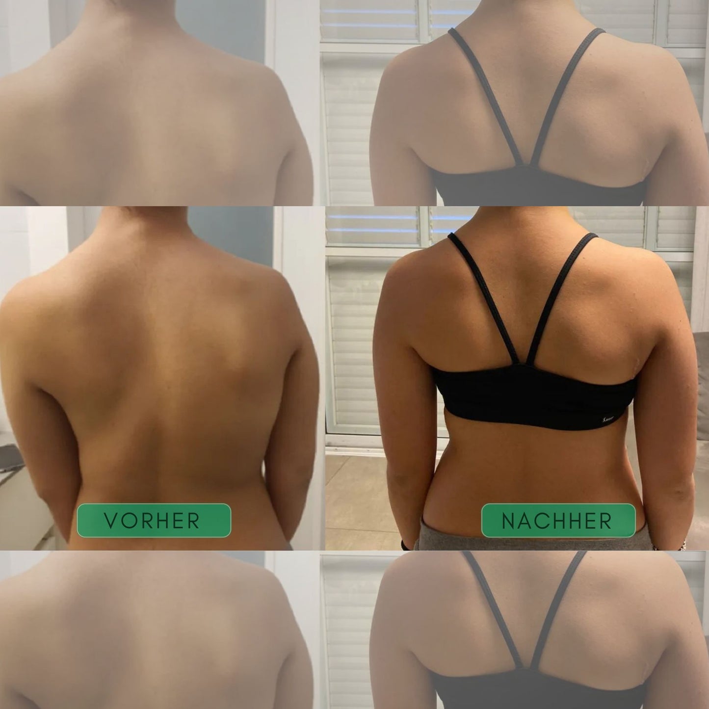 AlignFlex™ Posture Trainer
