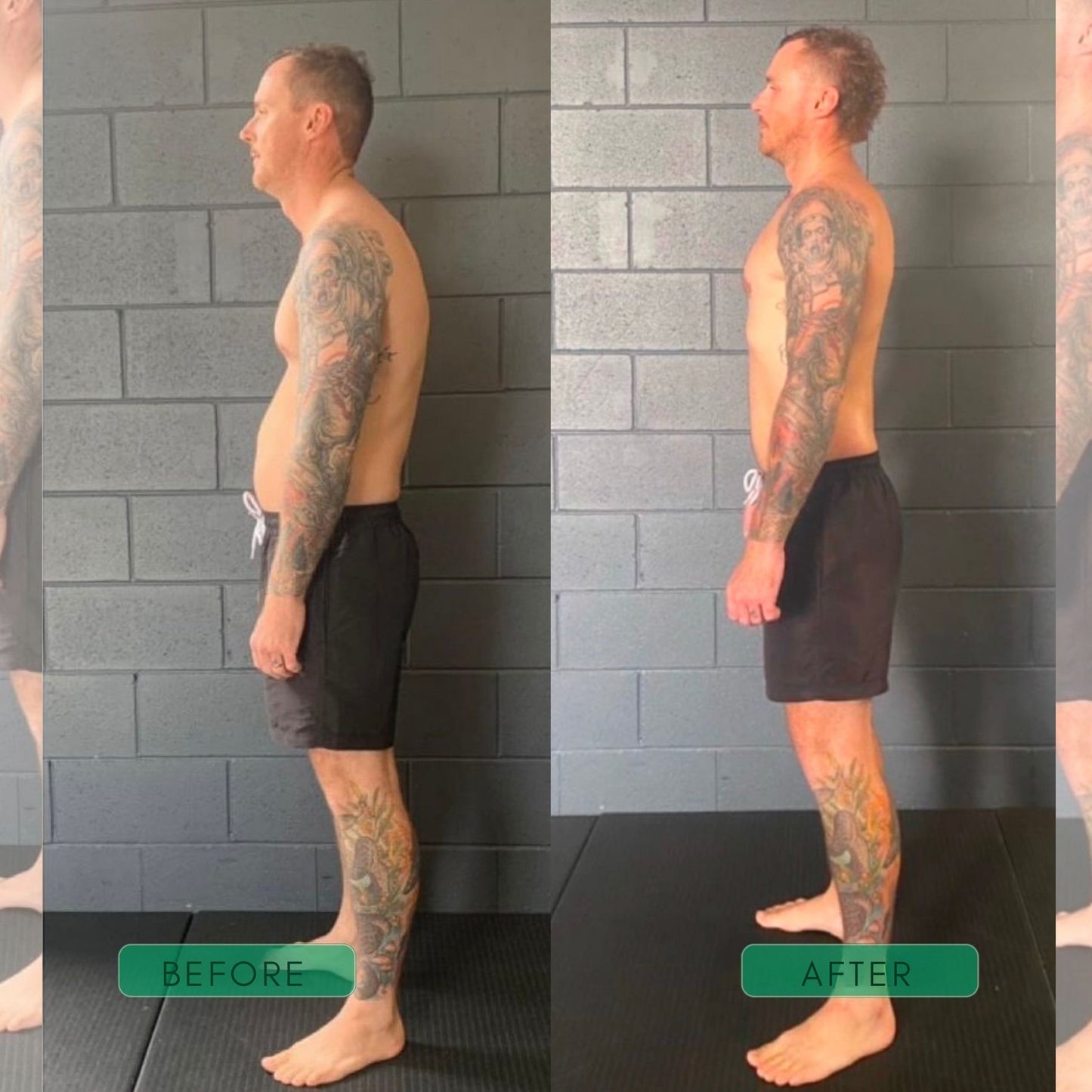 AlignFlex™ Posture System