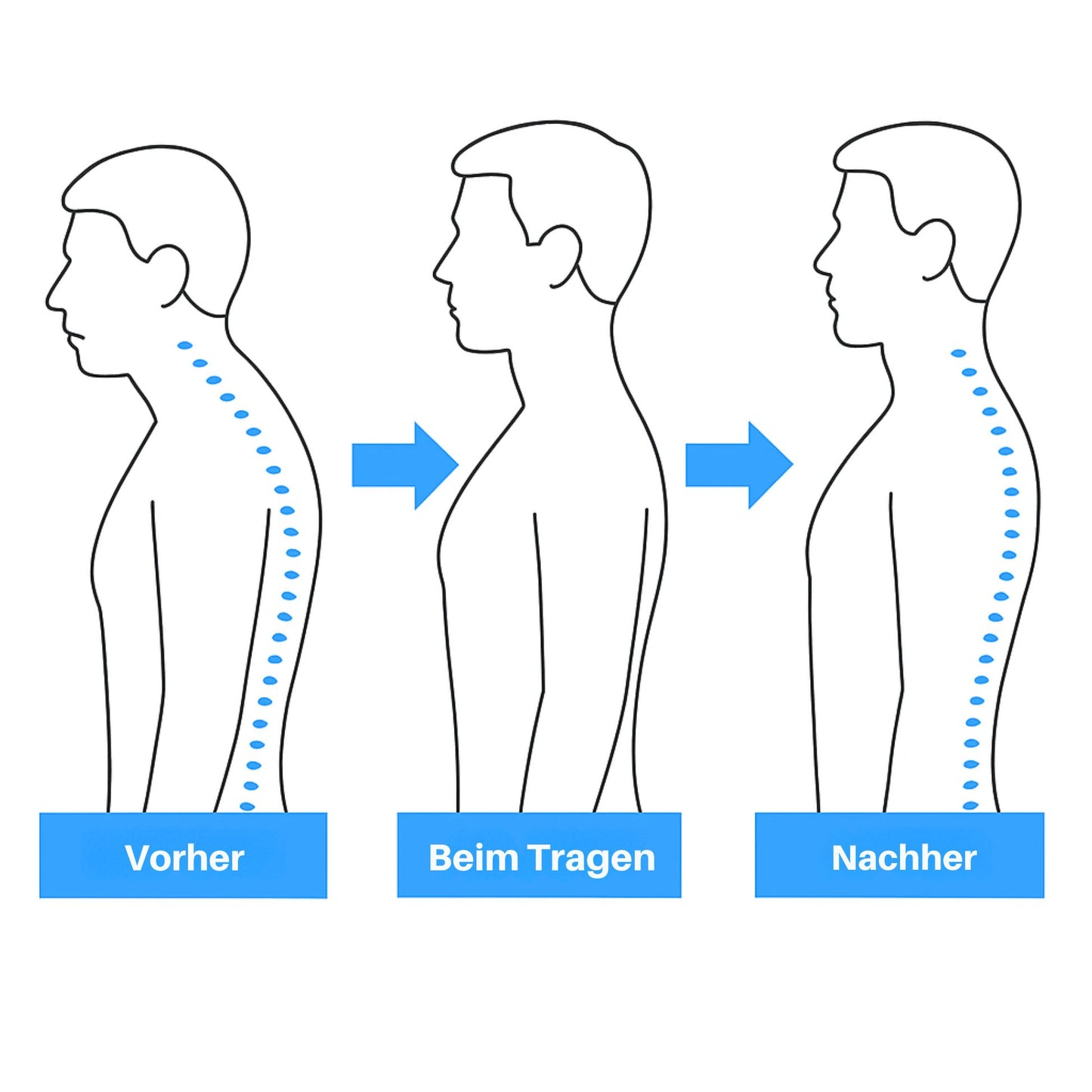 AlignFlex™ Posture Trainer