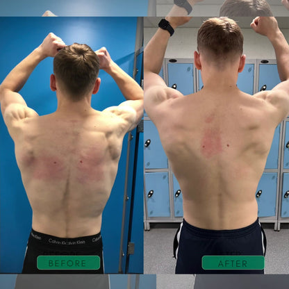 AlignFlex™ Instant Posture Corrector