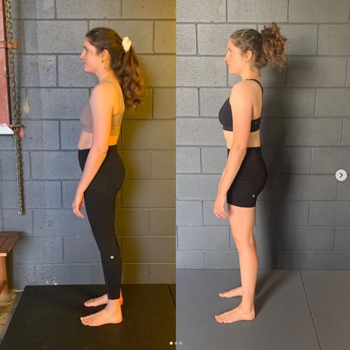 AlignFlex™ Posture System