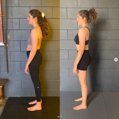 AlignFlex™ Posture System